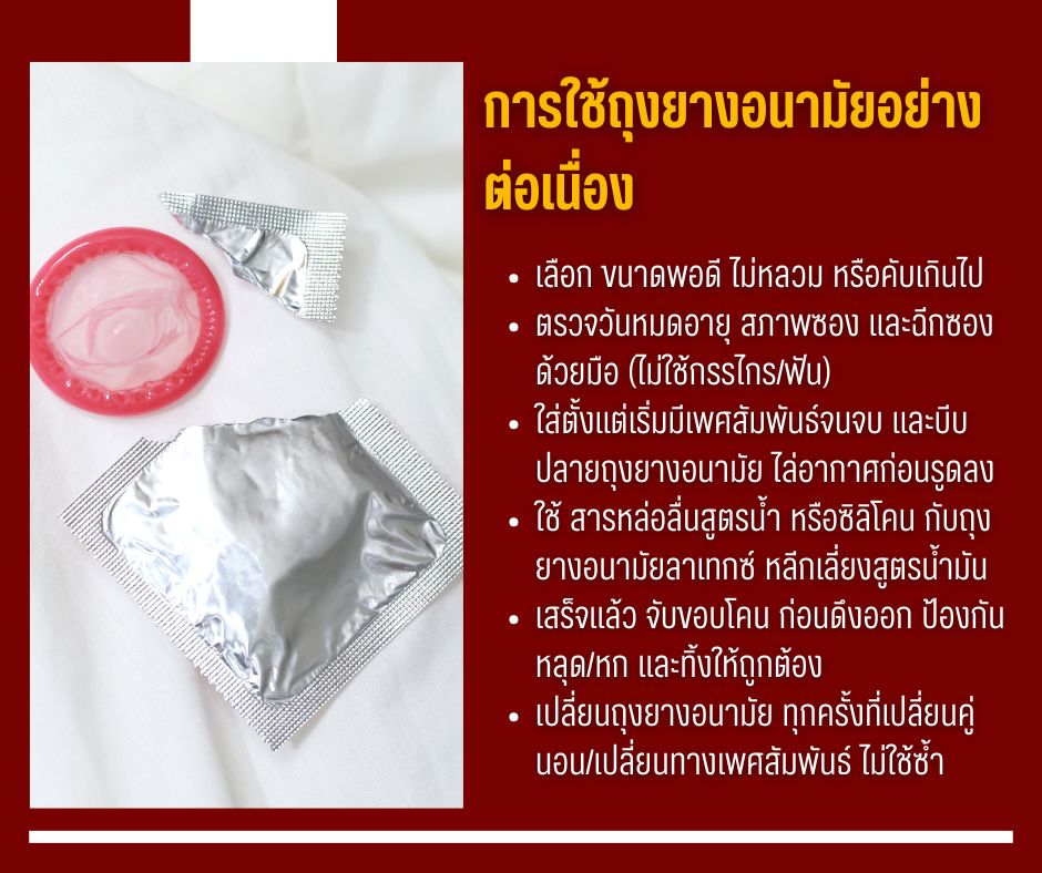 การใช้ถุงยางอนามัยอย่างต่อเนื่อง