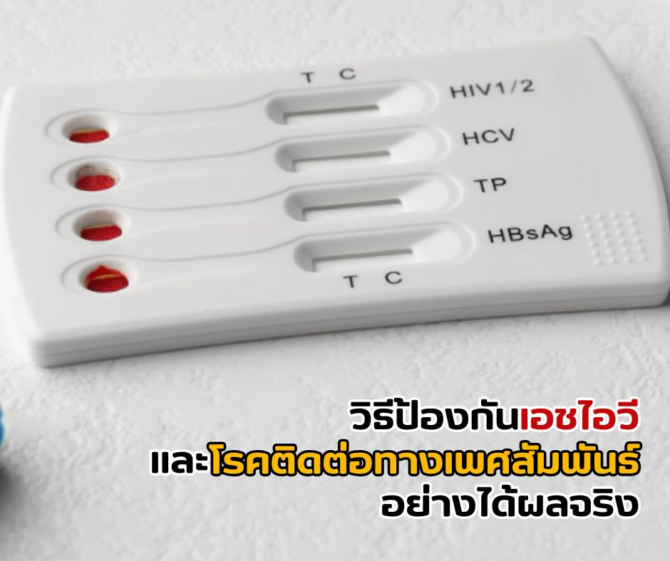 วิธีป้องกันเอชไอวี และโรคติดต่อทางเพศสัมพันธ์อย่างได้ผลจริง