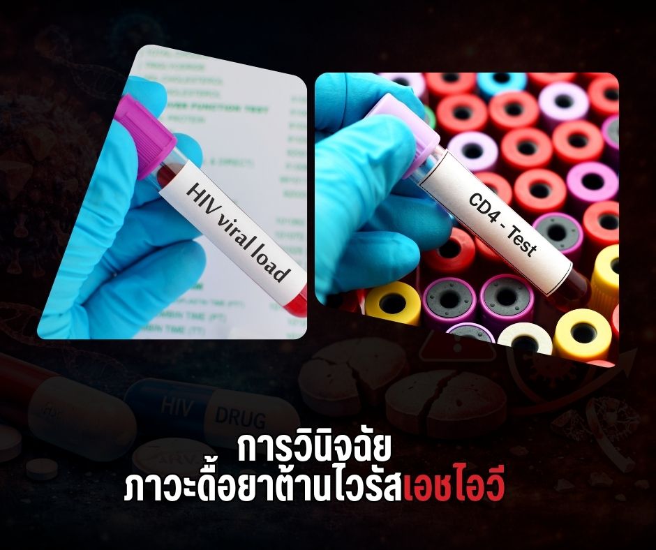 การวินิจฉัยภาวะดื้อยาต้านไวรัสเอชไอวี